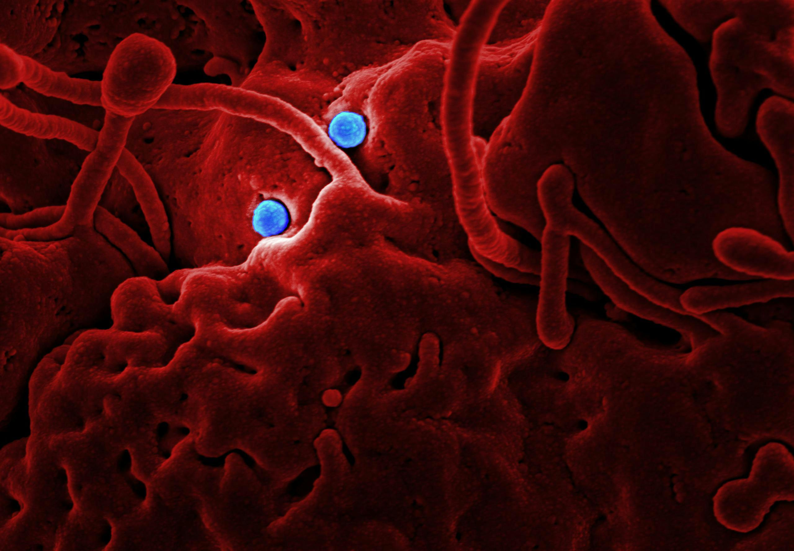 Ebola